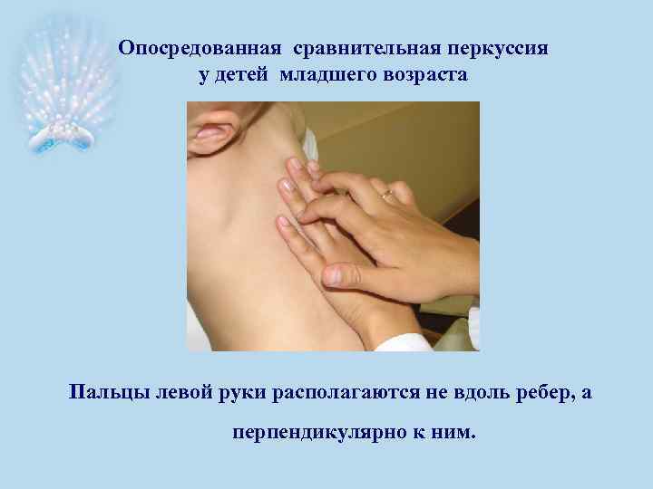 Опосредованная сравнительная перкуссия у детей младшего возраста Пальцы левой руки располагаются не вдоль ребер,