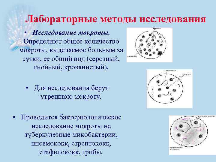 Лабораторные методы исследования • Исследование мокроты. Определяют общее количество мокроты, выделяемое больным за сутки,