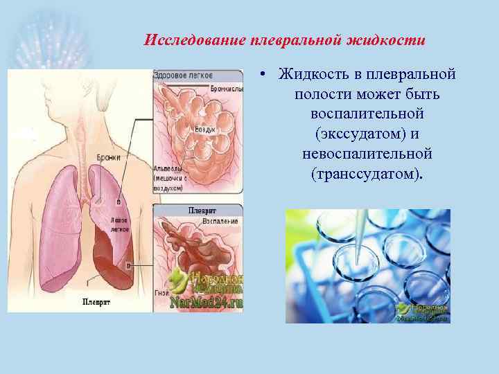 Исследование плевральной жидкости • Жидкость в плевральной полости может быть воспалительной (экссудатом) и невоспалительной
