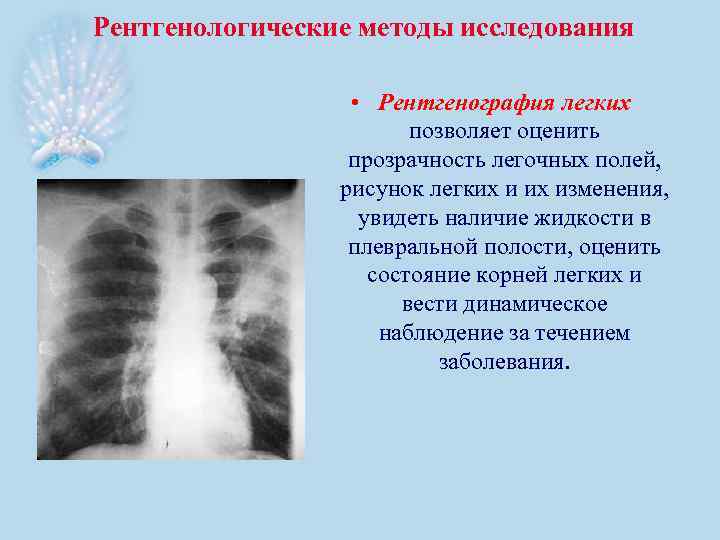 Рентгенологические методы исследования • Рентгенография легких позволяет оценить прозрачность легочных полей, рисунок легких изменения,