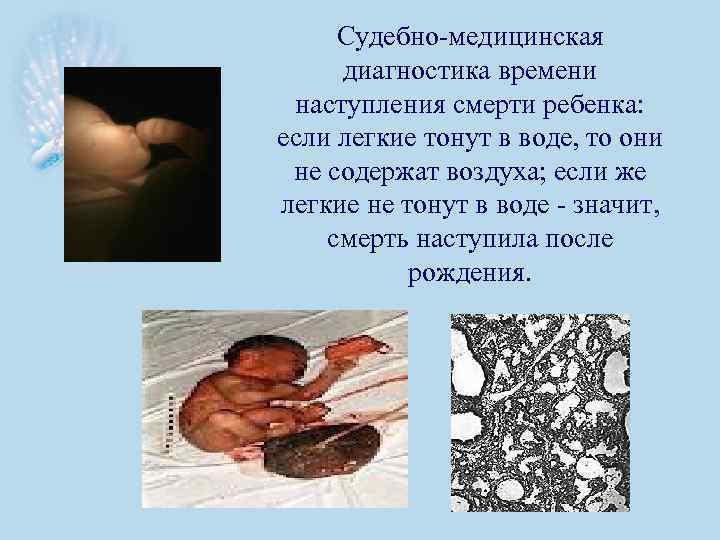 Судебно-медицинская диагностика времени наступления смерти ребенка: если легкие тонут в воде, то они не