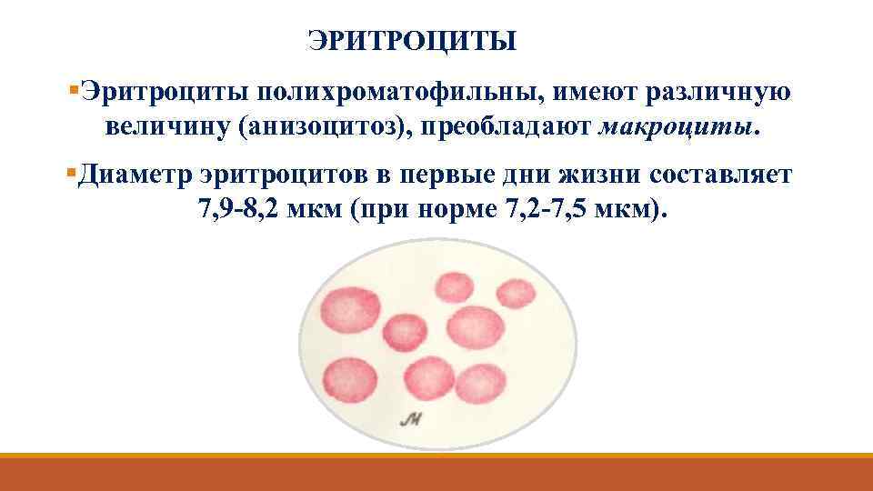 ЭРИТРОЦИТЫ §Эритроциты полихроматофильны, имеют различную величину (анизоцитоз), преобладают макроциты. §Диаметр эритроцитов в первые дни