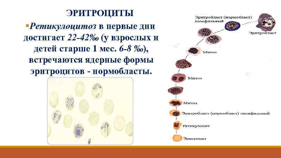 ЭРИТРОЦИТЫ §Ретикулоцитоз в первые дни достигает 22 -42‰ (у взрослых и детей старше 1