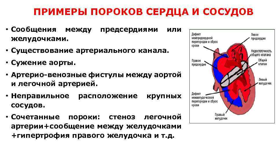 ПРИМЕРЫ ПОРОКОВ СЕРДЦА И СОСУДОВ • Сообщения между предсердиями или желудочками. • Существование артериального