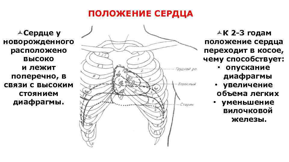 ПОЛОЖЕНИЕ СЕРДЦА ñСердце у новорожденного расположено высоко и лежит поперечно, в связи с высоким