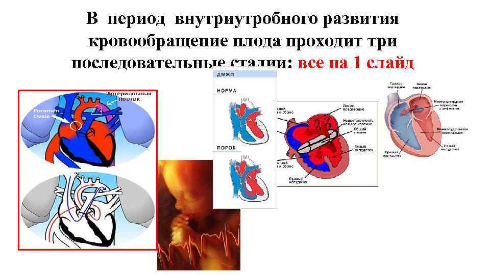 В период внутриутробного развития кровообращение плода проходит три последовательные стадии: все на 1 слайд