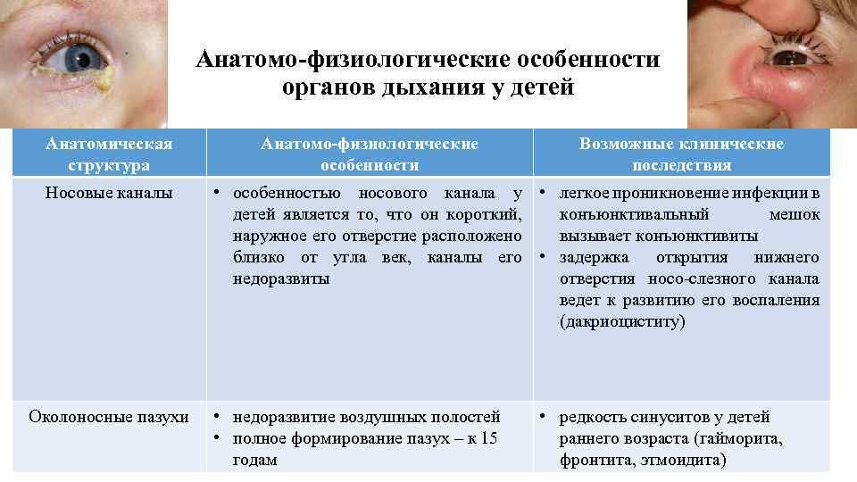 Анатомо-физиологические особенности органов дыхания у детей Анатомическая структура Носовые каналы Околоносные пазухи Анатомо-физиологические особенности