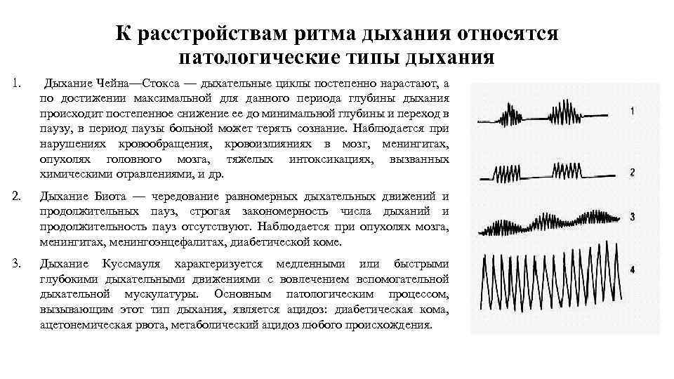 К расстройствам ритма дыхания относятся патологические типы дыхания 1. Дыхание Чейна—Стокса — дыхательные циклы