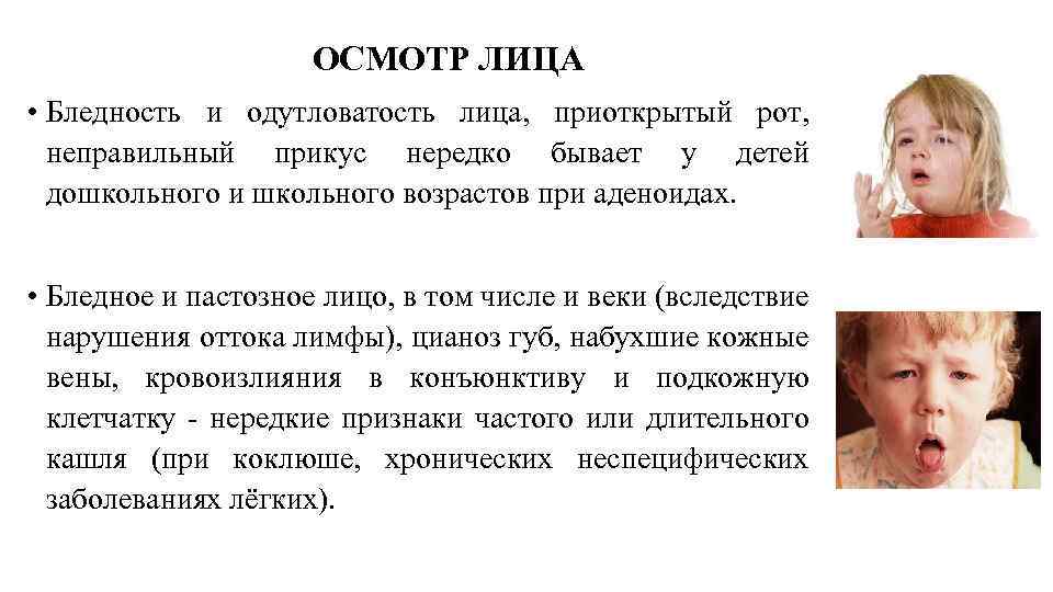 ОСМОТР ЛИЦА • Бледность и одутловатость лица, приоткрытый рот, неправильный прикус нередко бывает у