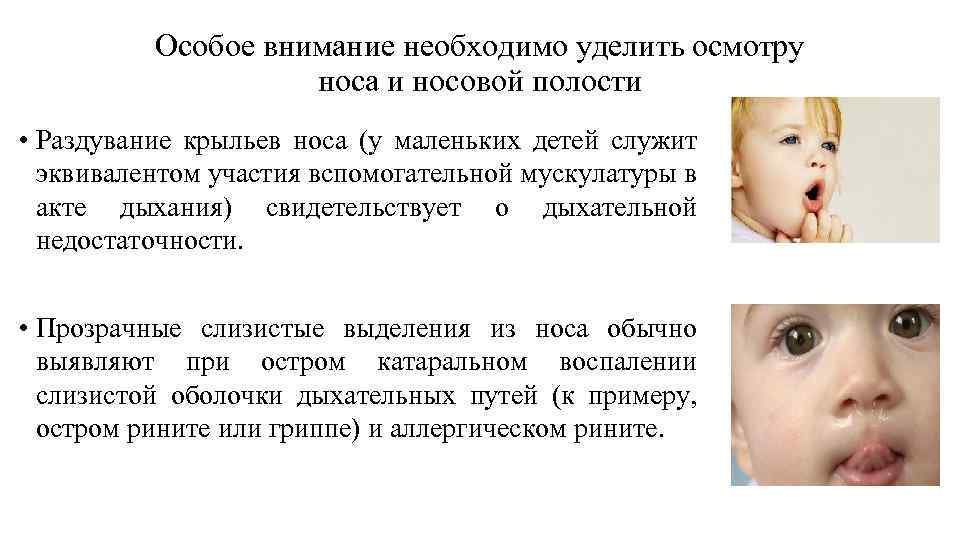 Особое внимание необходимо уделить осмотру носа и носовой полости • Раздувание крыльев носа (у