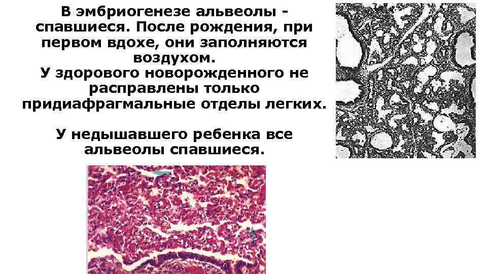 В эмбриогенезе альвеолы спавшиеся. После рождения, при первом вдохе, они заполняются воздухом. У здорового