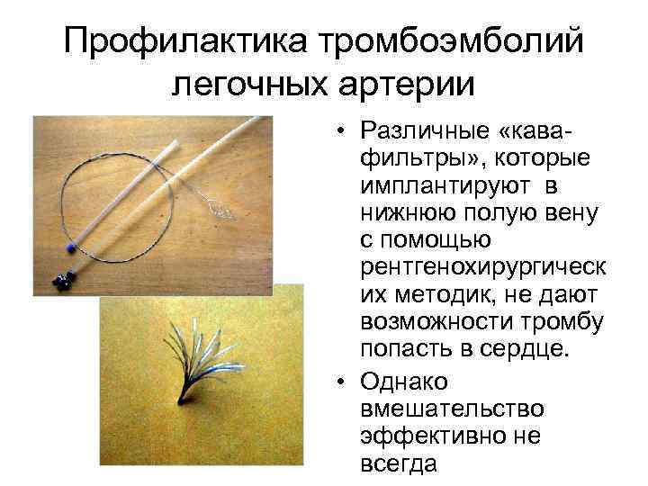 Профилактика тромбоэмболий легочных артерии • Различные «кавафильтры» , которые имплантируют в нижнюю полую вену