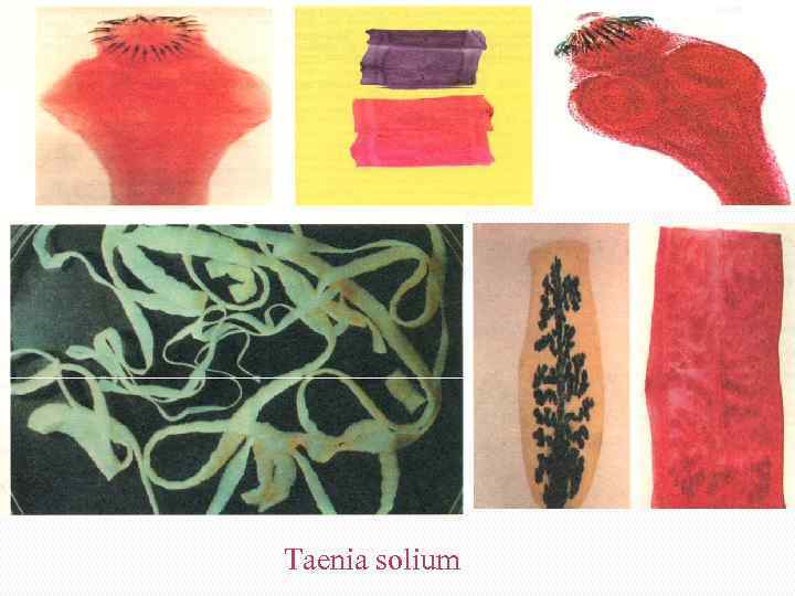 Taenia solium 