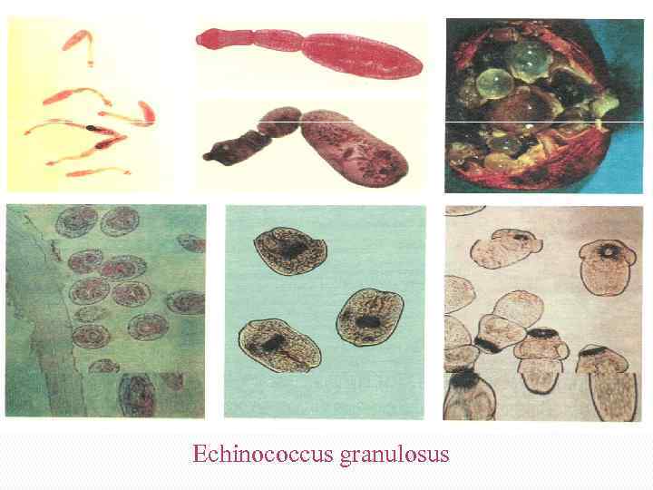 Echinococcus granulosus 