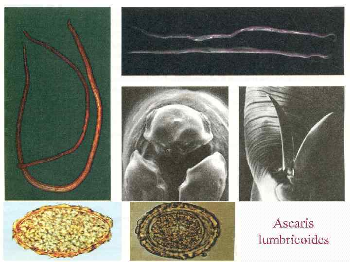 Ascaris lumbricoides 