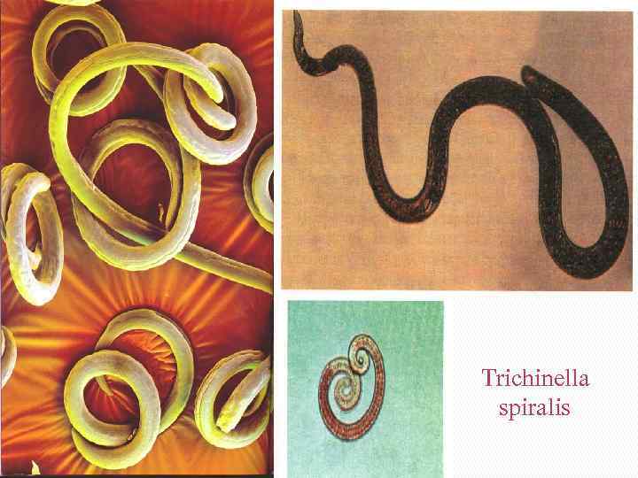 Trichinella spiralis 