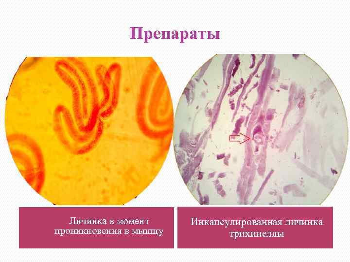 Личинка трихинеллы в мышцах рисунок с обозначениями