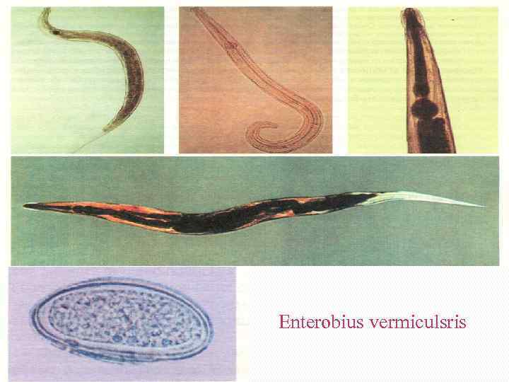 Enterobius vermiculsris 