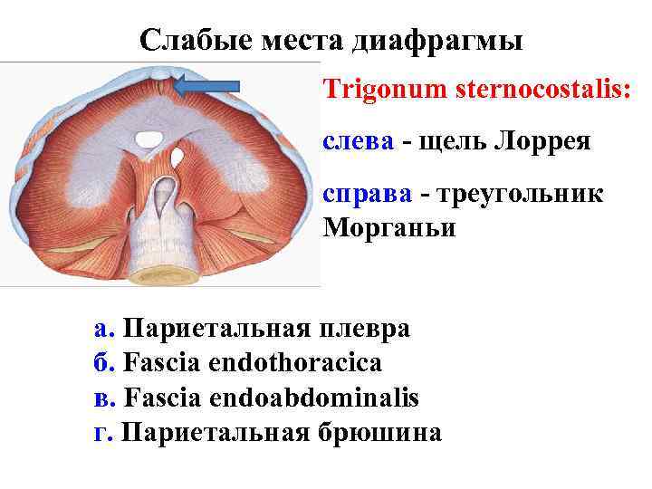 Слабые места диафрагмы Trigonum sternocostalis: слева - щель Лоррея справа - треугольник Морганьи а.