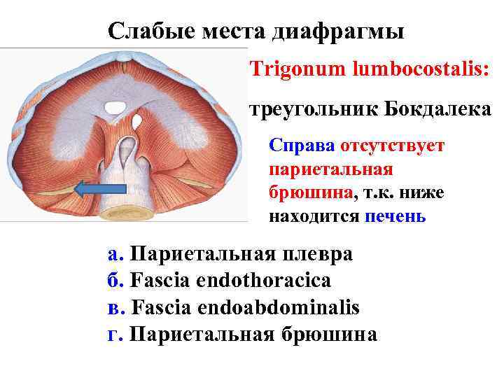 Слабые места диафрагмы Trigonum lumbocostalis: треугольник Бокдалека Справа отсутствует париетальная брюшина, т. к. ниже