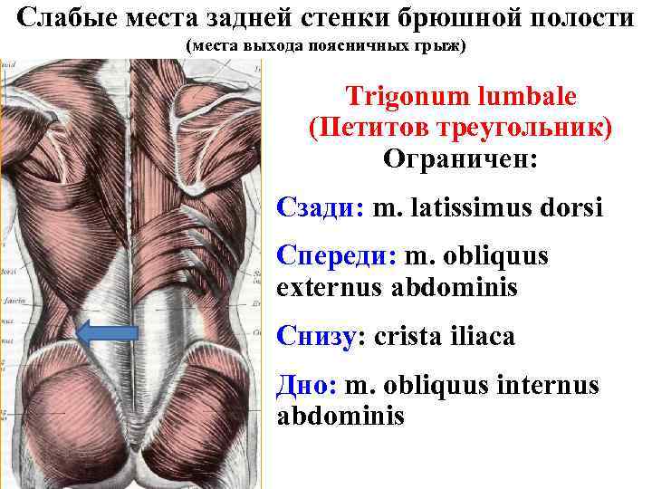 Слабые места задней стенки брюшной полости (места выхода поясничных грыж) Trigonum lumbale (Петитов треугольник)