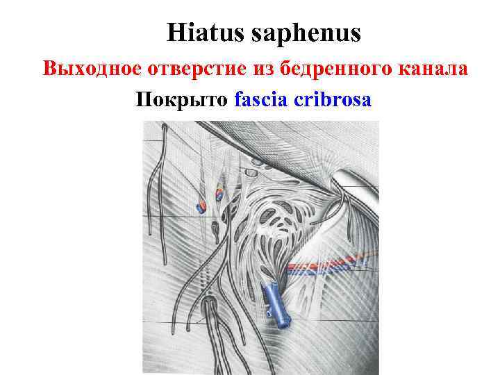 Hiatus saphenus Выходное отверстие из бедренного канала Покрыто fascia cribrosa 