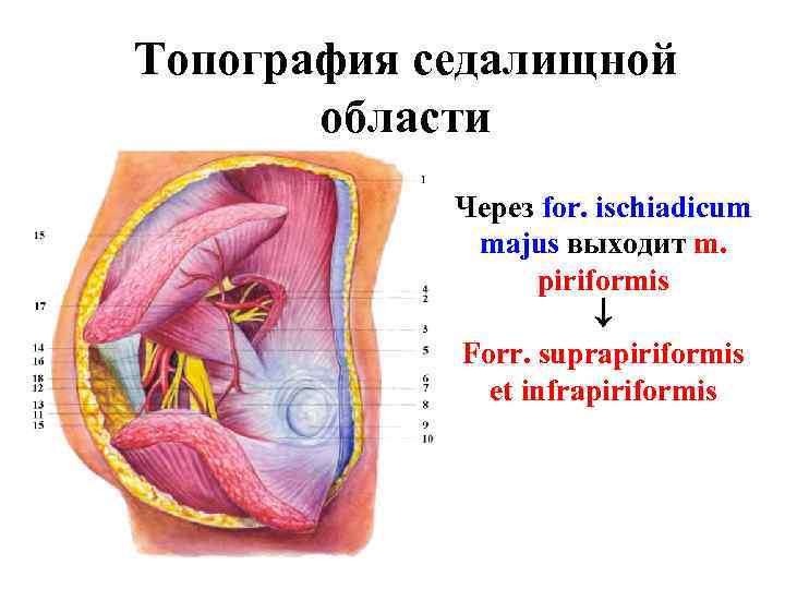 Топография седалищной области Через for. ischiadicum majus выходит m. piriformis Forr. suprapiriformis et infrapiriformis