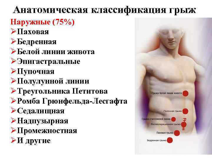 Анатомическая классификация грыж Наружные (75%) ØПаховая ØБедренная ØБелой линии живота ØЭпигастральные ØПупочная ØПолулунной линии