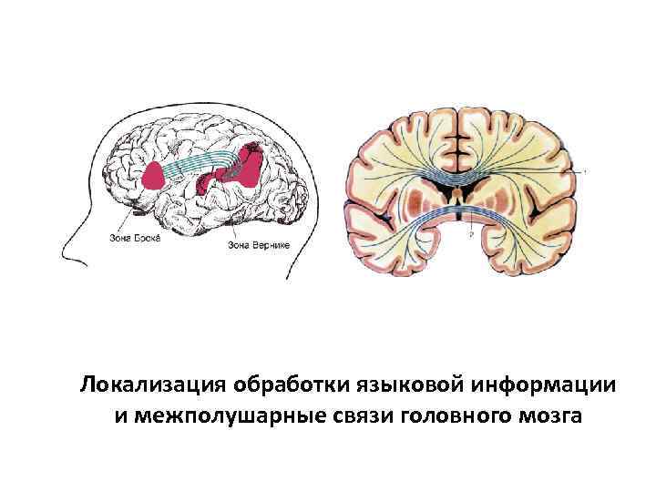 Локализация обработки языковой информации и межполушарные связи головного мозга 