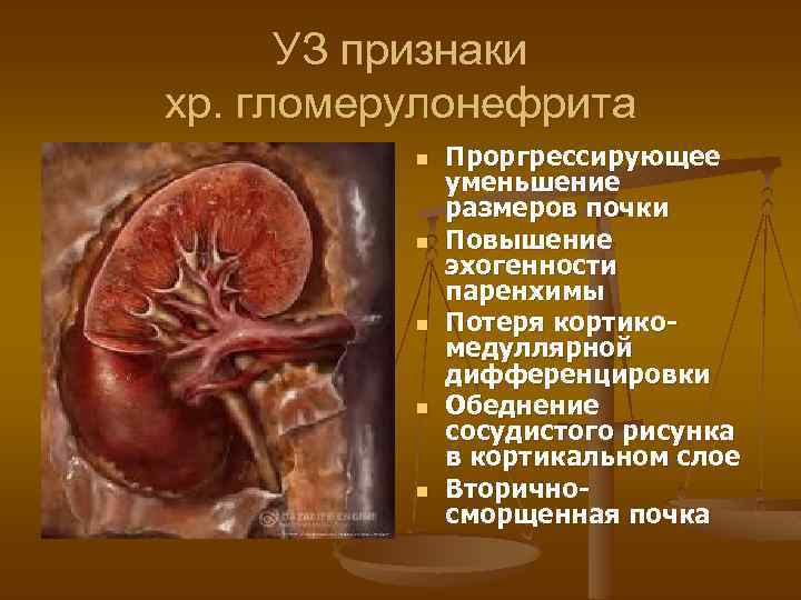 УЗ признаки хр. гломерулонефрита n n n Проргрессирующее уменьшение размеров почки Повышение эхогенности паренхимы