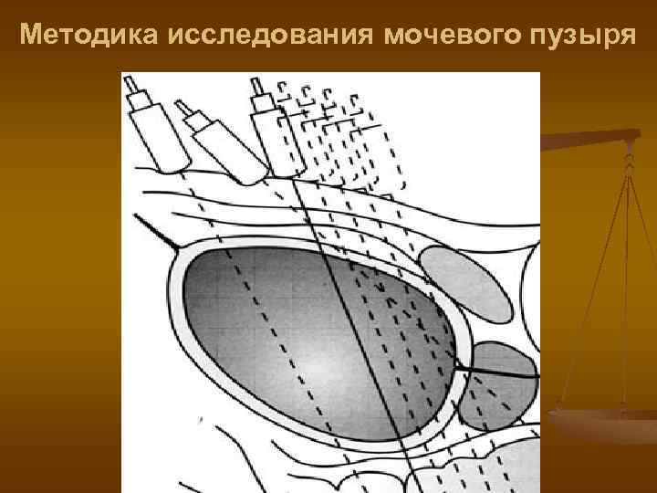 Методика исследования мочевого пузыря 
