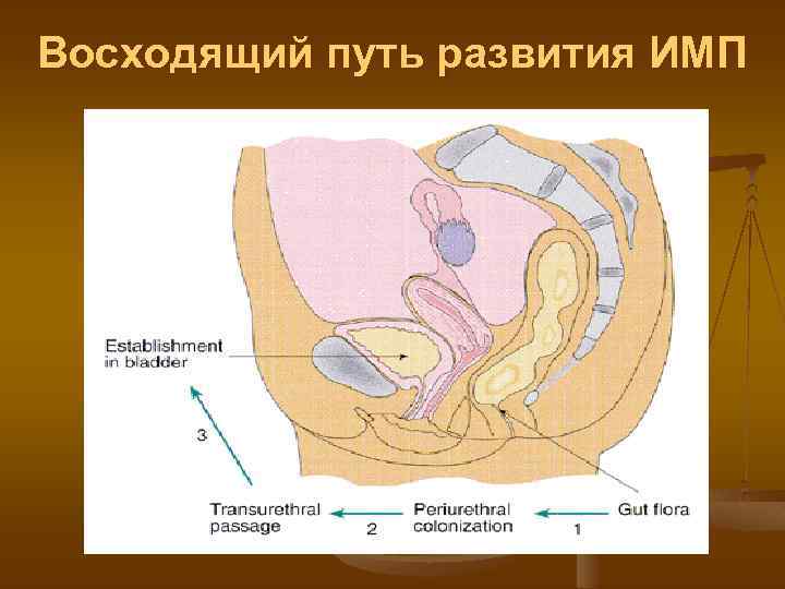 Восходящий путь развития ИМП 