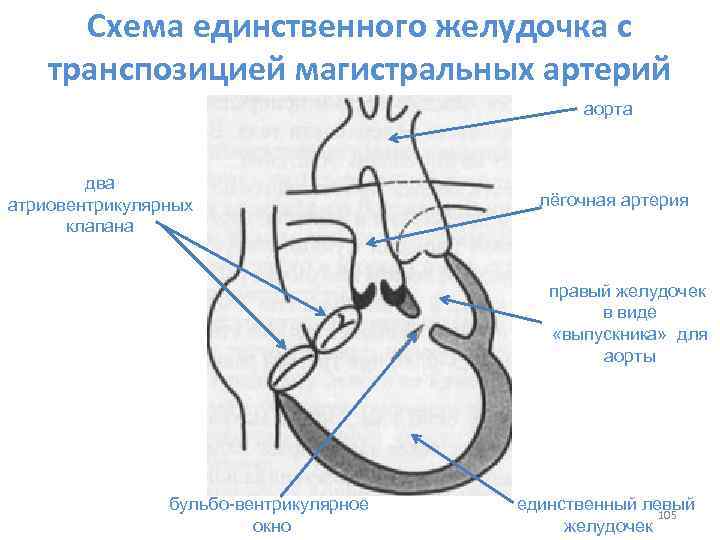 Дисфункция клапана легочной артерии