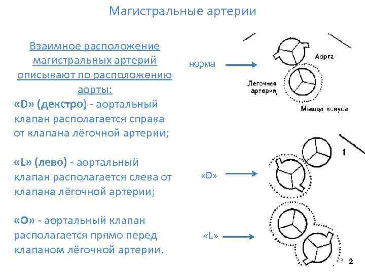 Магистральные артерии Взаимное расположение магистральных артерий описывают по расположению аорты: «D» (декстро) - аортальный