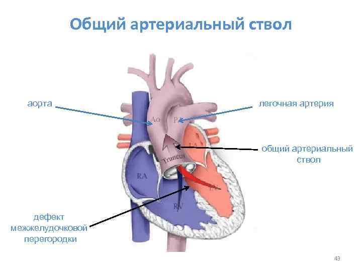 По схеме кренлейна брюсовой основной ствол средней менингеальной артерии проецируется на пересечении