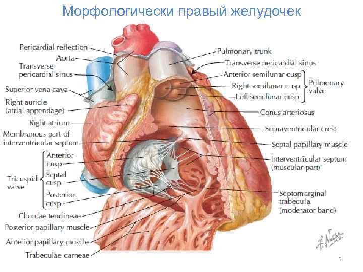 Морфологически правый желудочек 5 