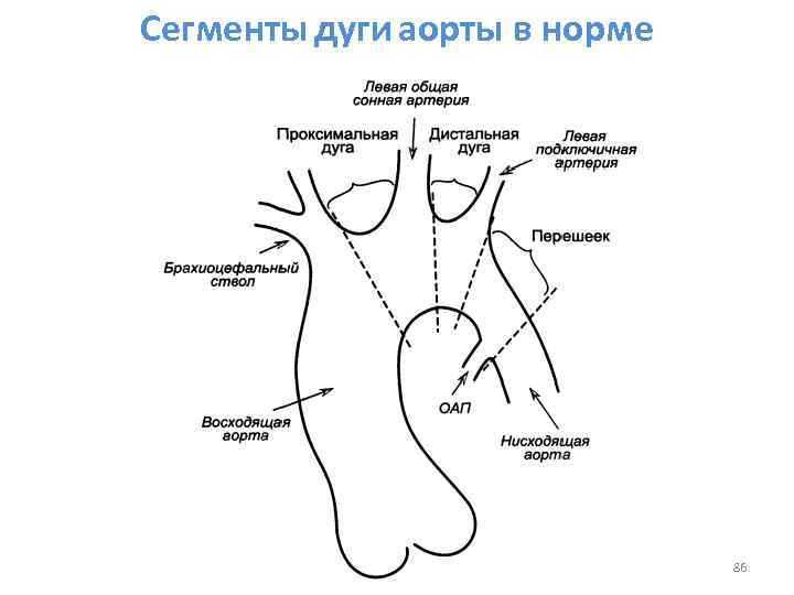 Схема артерий дуги аорты