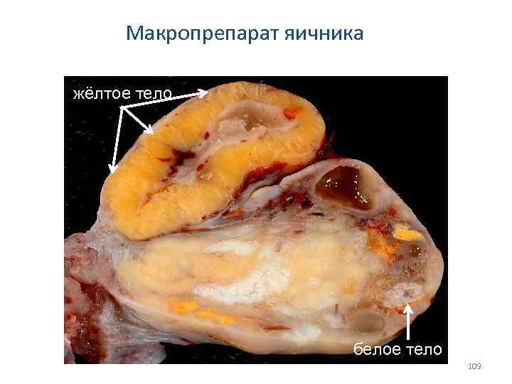 Макропрепарат яичника жёлтое тело белое тело 109 