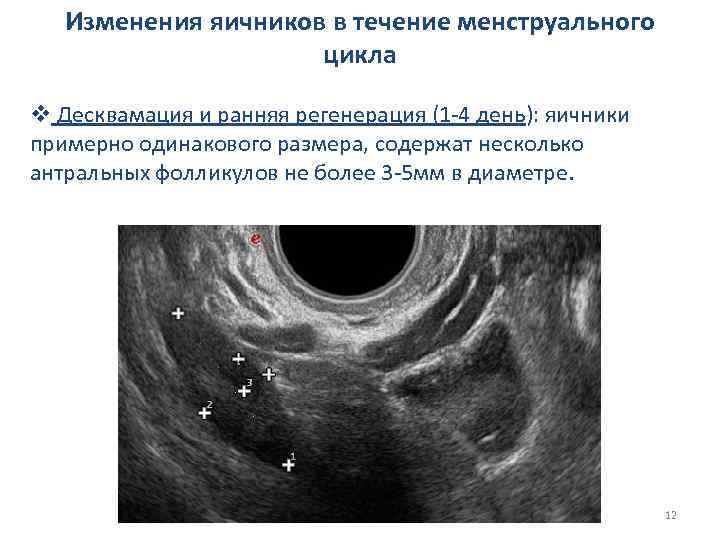 Изменения яичников в течение менструального цикла v Десквамация и ранняя регенерация (1 -4 день):