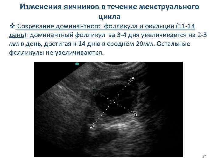 Изменения яичников в течение менструального цикла v Созревание доминантного фолликула и овуляция (11 -14
