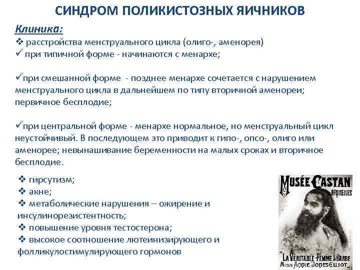 СИНДРОМ ПОЛИКИСТОЗНЫХ ЯИЧНИКОВ Клиника: v расстройства менструального цикла (олиго-, аменорея) ü при типичной форме