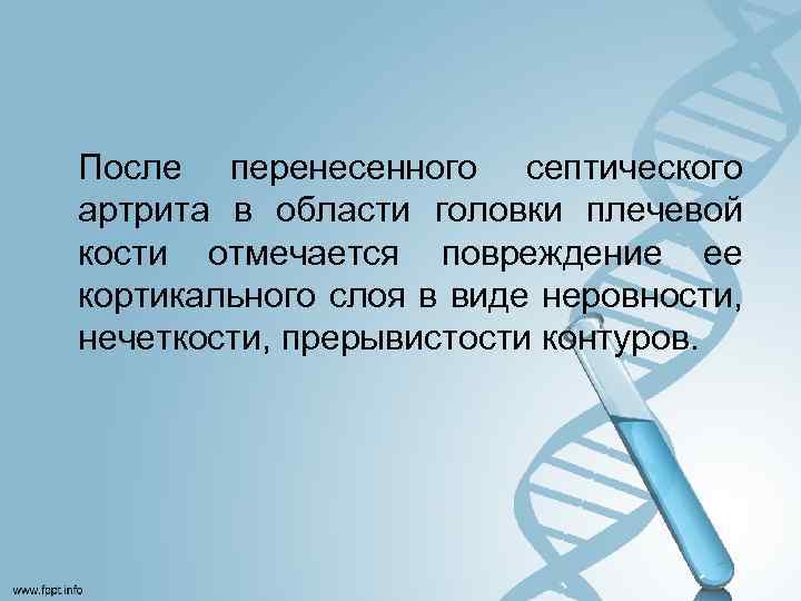 После перенесенного септического артрита в области головки плечевой кости отмечается повреждение ее кортикального слоя