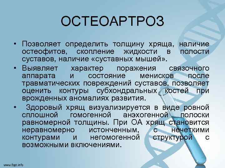 ОСТЕОАРТРОЗ • Позволяет определить толщину хряща, наличие остеофитов, скопление жидкости в полости суставов, наличие