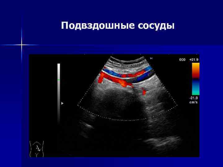 Карта вызова тромбоз сосудов нижних конечностей