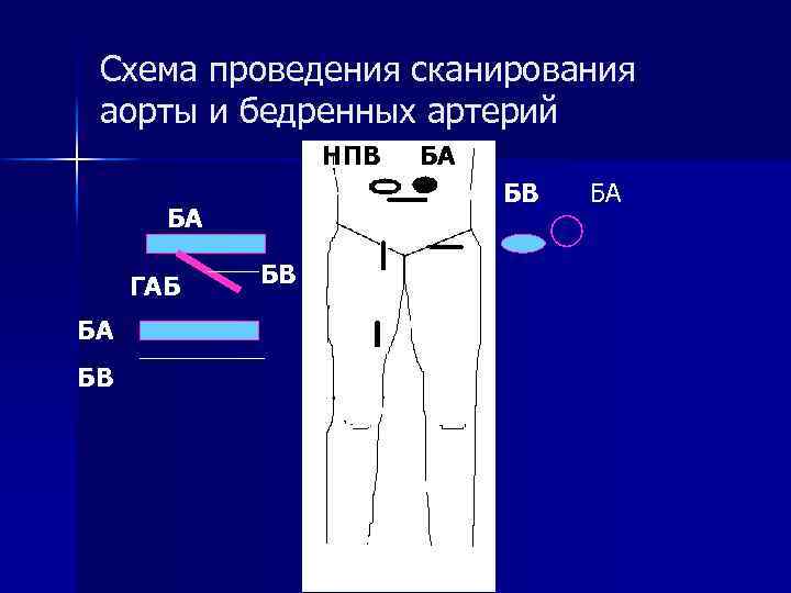 Схема проведения сканирования аорты и бедренных артерий НП НПВ БА НПВ В БА ГАБ