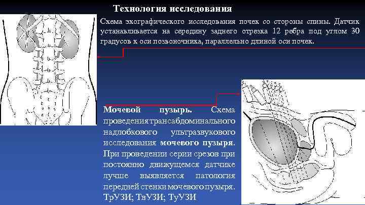 Технология исследования Схема эхографического исследования почек со стороны спины. Датчик устанавливается на середину заднего