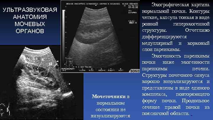 Эхографическая картина почек