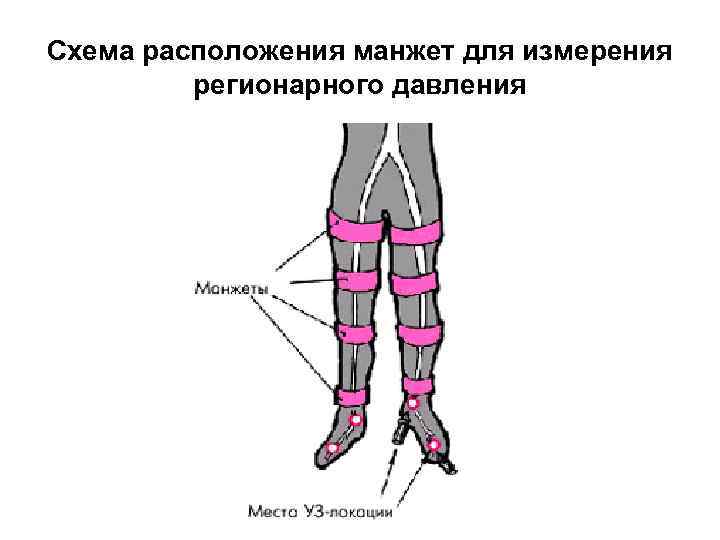 Схема расположения манжет для измерения регионарного давления 