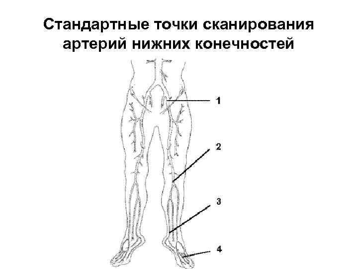 Стандартные точки сканирования артерий нижних конечностей 