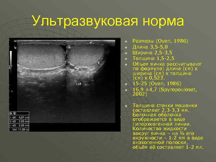 Ультразвуковая норма u u u u Размеры (Oyen, 1986) Длина 3, 5 -5, 0